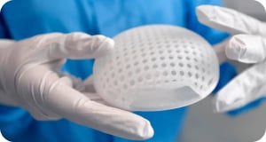 A Lattice Medical lab researcher holding a 3D printed breast implant.